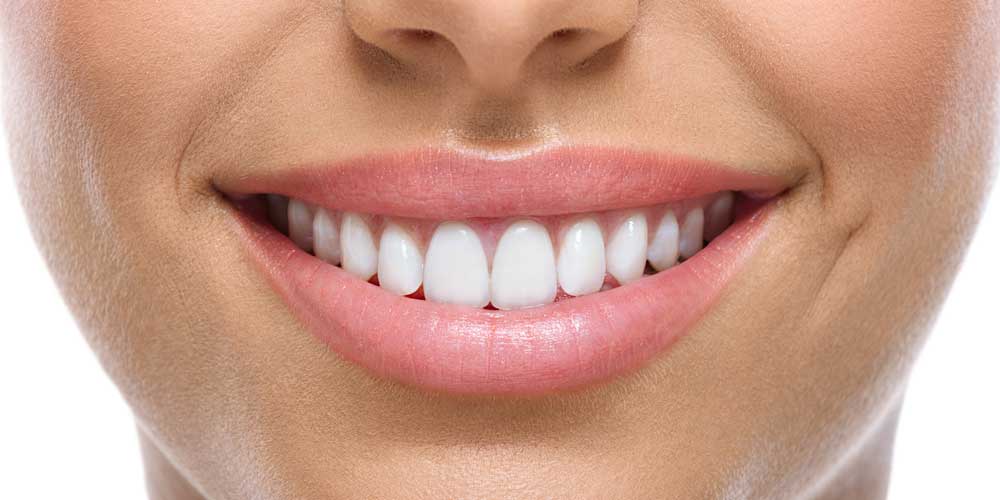 Smiling woman with beautiful teeth from dental cosmetic tooth bonding