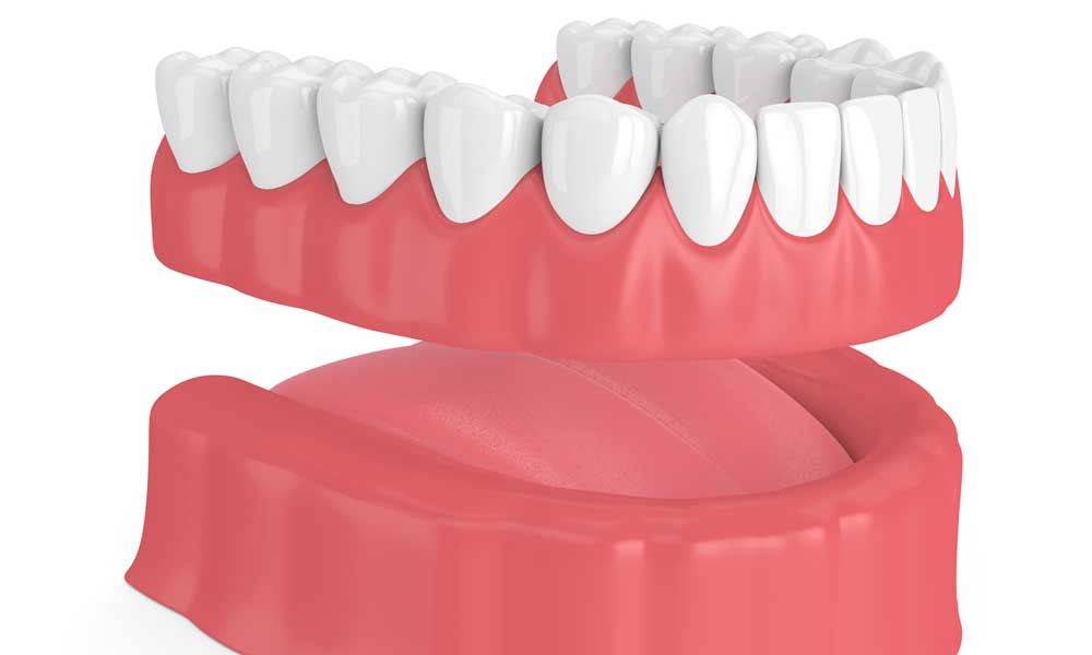 Dentures illustration