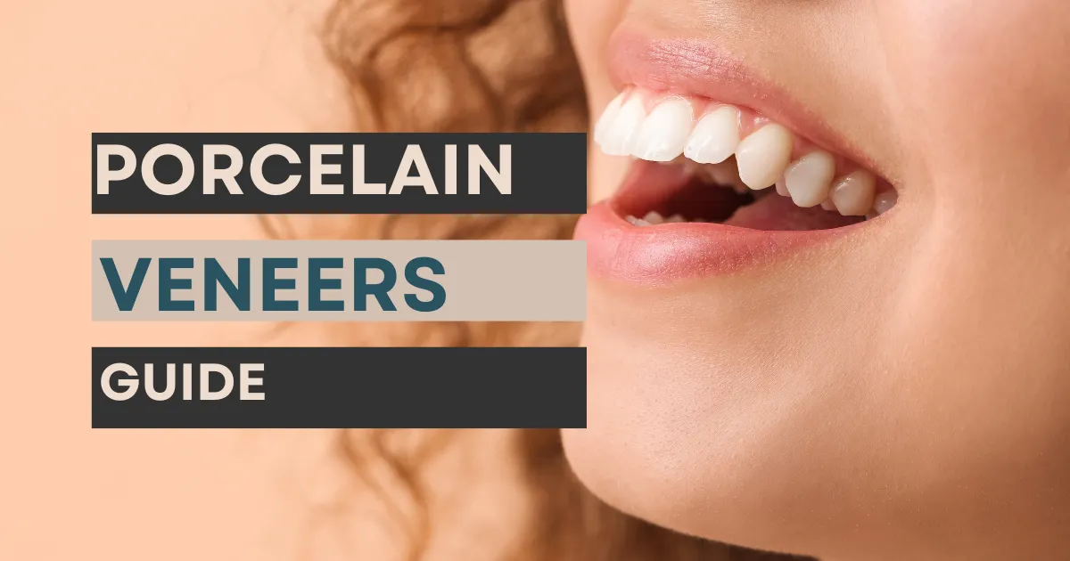 Porcelain Veneers Guide Northbrook