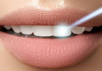 Laser Dentistry Laser Dentistry Smile